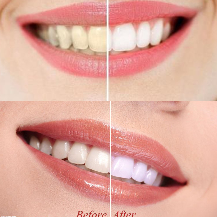 Bambusowy węgiel drzewny zęby  – Teeth Whitening Co recenzja i cena