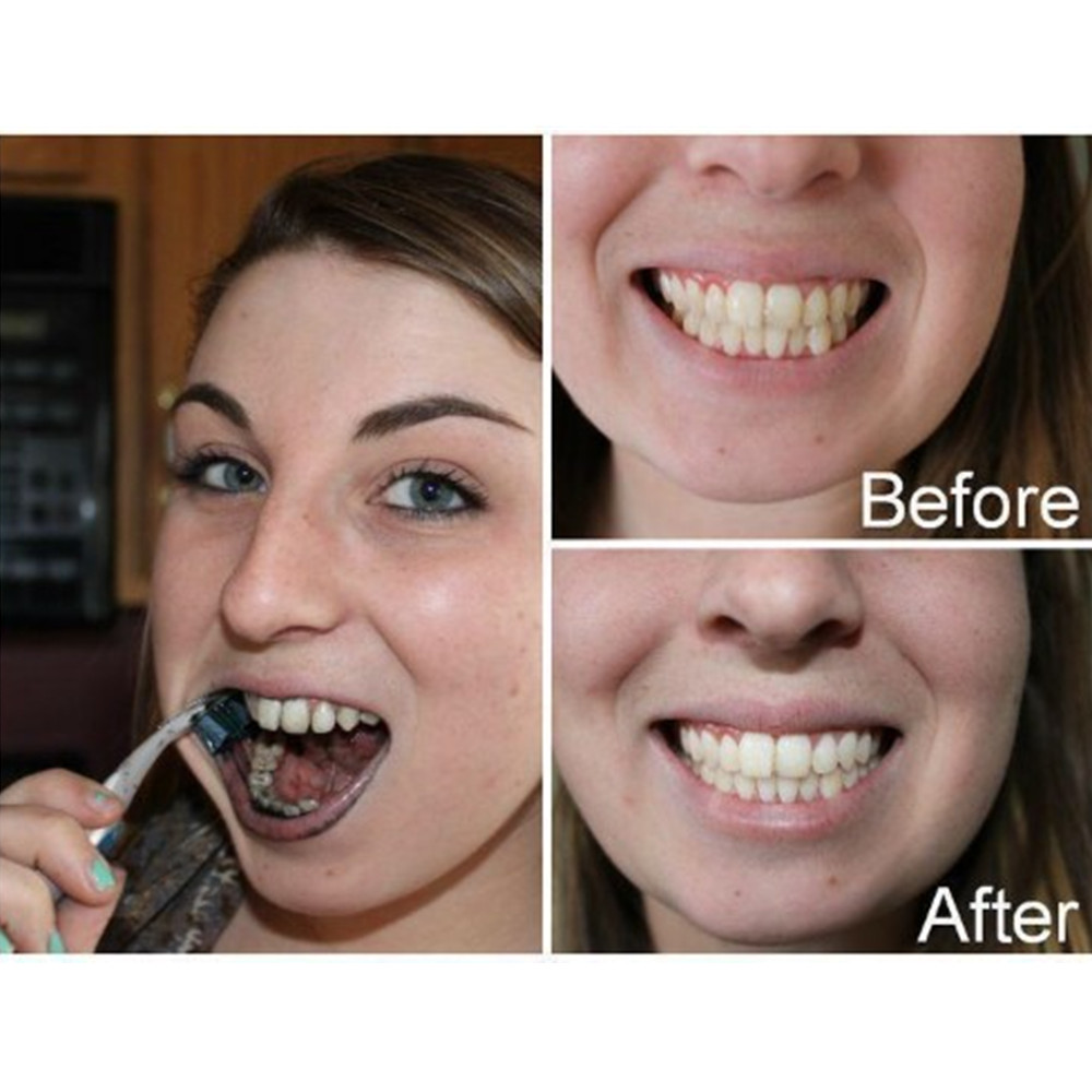 Bambusowy węgiel drzewny zęby  – Teeth Whitening Co recenzja i cena