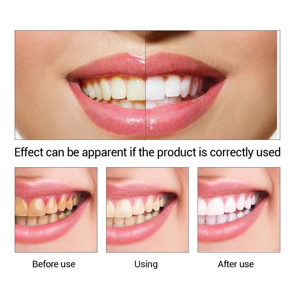 FTEENPLY esencja do wybielania – Teeth Whitening Co recenzja i cena