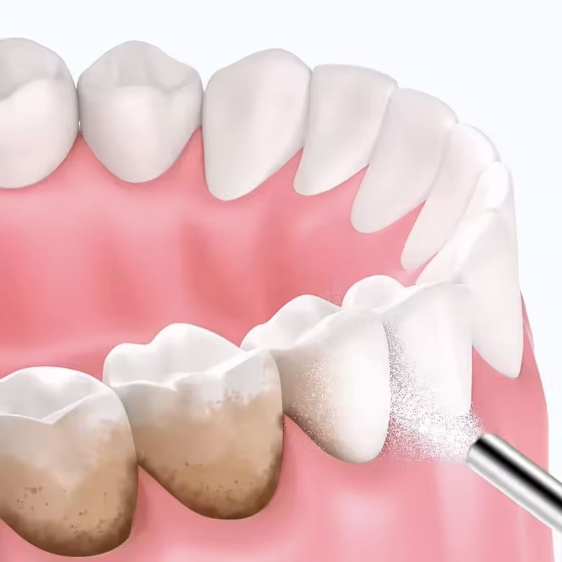 130g Proszek do piaskowania zę – Teeth Whitening Co recenzja i cena