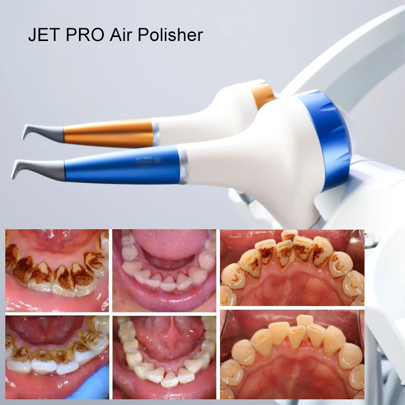 VV Dental Air Polishing Prophy – Teeth Whitening Free recenzja i cena