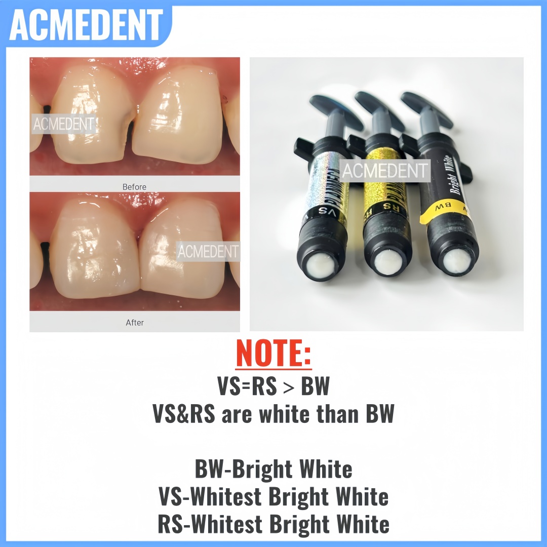 4,5g Kompozyt Dentystyczny Żyw – Teeth Whitening Vs Veneers recenzja i cena